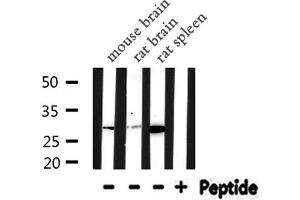 Western blot analysis of CA2 expression in various lysates (CA2 antibody  (C-Term))