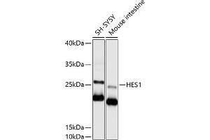 Western blot analysis of extracts of various cell lines, using HES1 antibody (ABIN6129271, ABIN6141726, ABIN6141728 and ABIN6215415) at 1:1000 dilution. (HES1 antibody  (AA 151-280))