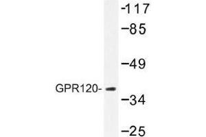 Image no. 1 for anti-omega-3 Fatty Acid Receptor 1 (O3FAR1) antibody (ABIN317737) (O3FAR1 antibody)