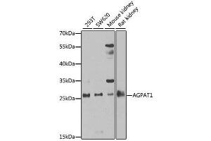 Western blot analysis of extracts of various cell lines, using AGPAT1 antibody.
