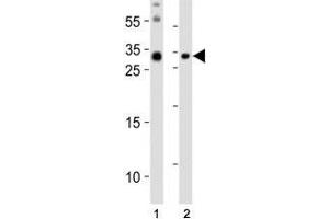 Western blot analysis of lysate from (1) mouse brain and (2) mouse skeletal muscle tissue lysate using Olig3 antibody at 1:1000. (OLIG3 antibody  (N-Term))