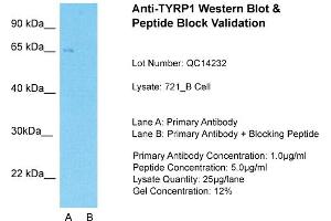 Host: Rabbit  Target Name: TYRP1  Sample Tissue: Human 721_BLane A:  Primary Antibody Lane B:  Primary Antibody + Blocking Peptide Primary Antibody Concentration: 1 µg/mL Peptide Concentration: 5. (Tyrosinase-Related Protein 1 antibody  (Middle Region))