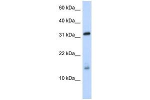 EIF1AX antibody used at 1 ug/ml to detect target protein.