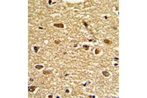 Image no. 2 for anti-Ets Variant 4 (ETV4) (AA 426-455), (C-Term) antibody (ABIN452983) (ETV4 antibody  (C-Term))