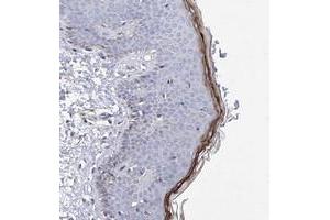 Immunohistochemical staining of human skin with HRNR polyclonal antibody  shows distinct positivity in granular layer cells.