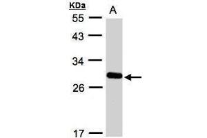 Western blot analysis of 30 ug whole cell lysate (A:A431) using a 12 % SDS PAGE gel and YIPF4 antibody at a dilution of 1:1000 (YIPF4 antibody)