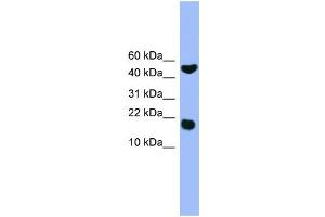 WB Suggested Anti-RWDD1  Antibody Titration: 0. (RWDD1 antibody  (Middle Region))