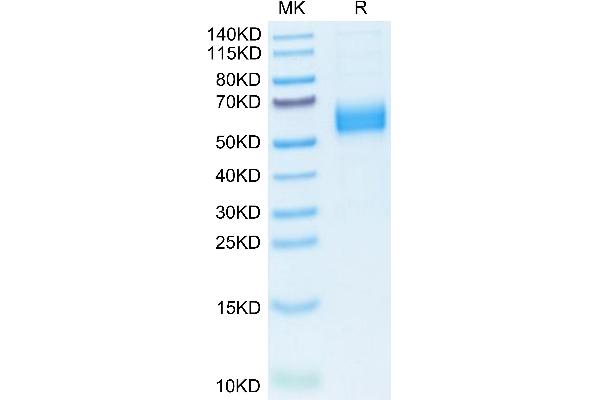 IL1R1 Protein (AA 20-338) (His tag)