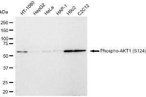Western blotting analysis using Phospho-AKT1 (S124) antibody (ABIN7800784). (Recombinant AKT1 antibody  (pSer124))