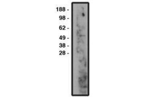 Image no. 1 for anti-Sphingomyelin Phosphodiesterase 3 (SMPD3) antibody (ABIN793721)