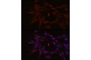 Immunofluorescence analysis of PC-12 cells using TYK2 Rabbit pAb (ABIN3022987, ABIN3022988, ABIN3022989 and ABIN6219333) at dilution of 1:150 (40x lens). (TYK2 antibody  (AA 750-850))