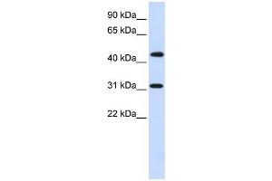 Human Brain; WB Suggested Anti-ZNF684 Antibody Titration: 0.