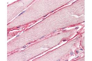 Anti-SGCD / Delta-Sarcoglycan antibody IHC of human skeletal muscle. (SGCD antibody  (AA 244-256))