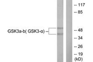 Western blot analysis of extracts from 293 cells, treated with TNF-a 20ng/ml 30', using GSK3 alpha/beta (Ab-279/216) Antibody. (GSK3 alpha/beta antibody  (AA 246-295))