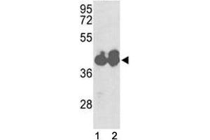 Western blot analysis of IDH1 antibody and HepG2 cell line and mouse liver tissue lysate. (IDH1 antibody  (AA 116-143))