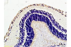 Immunohistochemistry (IHC) image for anti-Caveolin 1, Caveolae Protein, 22kDa (CAV1) (AA 2-120) antibody (ABIN686752)