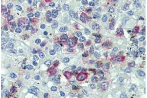 Human Spleen: Formalin-Fixed, Paraffin-Embedded (FFPE) (FASL antibody  (AA 82-145))