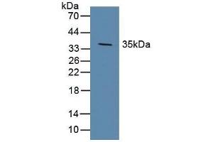 Detection of DKK1 in Porcine Brain Tissue using Polyclonal Antibody to Dickkopf Related Protein 1 (DKK1) (DKK1 antibody  (AA 33-266))