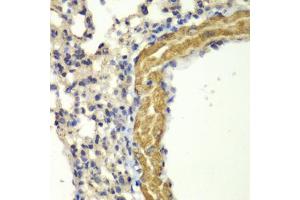 Immunohistochemistry of paraffin-embedded mouse lung using PRKG1 antibody (ABIN5971390) at dilution of 1/100 (40x lens). (PRKG1 antibody)