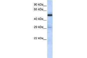 WB Suggested Anti-SCML1 Antibody Titration:  0. (SCML1 antibody  (Middle Region))