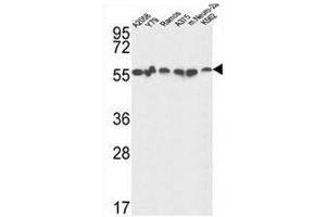 GPI Antibody (C-term) western blot analysis in A2058,Y79,Ramos,A375,K562 and mouse Neuro-2a cell line lysates (35µg/lane). (GPI antibody  (C-Term))