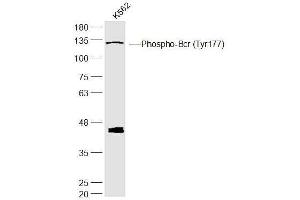 K562 lysates probed with Phospho-Bcr (Tyr177) Polyclonal Antibody, Unconjugated  at 1:300 dilution and 4˚C overnight incubation. (BCR antibody  (pTyr177))