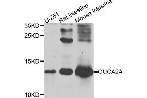 Western blot analysis of extracts of various cell lines, using GUCA2A antibody. (GUCA2A antibody)
