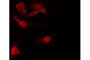 ABIN6275452 staining  HeLa cells by IF/ICC. (IQGAP1 antibody  (N-Term))