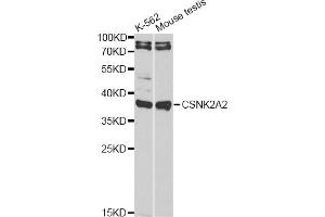 Western blot analysis of extracts of various cell lines, using CSNK2A2 antibody (ABIN6290214) at 1:1000 dilution.