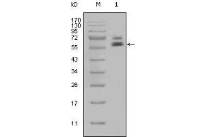Western blot analysis using CK5 mouse mAb against Hela cell lysate (1). (Cytokeratin 5 antibody)