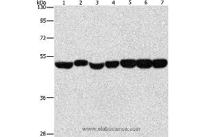Western blot analysis of Hela, A431 and hepG2 cell, mouse brain and liver tissue, mouse pancreas and human fetal brain tissue, using ENO1 Polyclonal Antibody at dilution of 1:700 (ENO1 antibody)