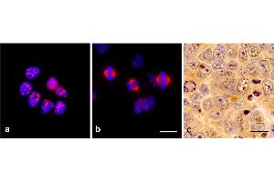 Immunocytochemistry of TPX2 using monoclonal antibody TPX2-01 in glioblastoma cell line T98G: a) interphase, b) mitosis. (TPX2 antibody)