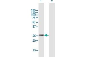 Western Blot analysis of IGFBP6 expression in transfected 293T cell line by IGFBP6 MaxPab polyclonal antibody. (IGFBP6 antibody  (AA 1-240))
