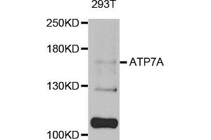 Western blot analysis of extracts of 293T cells, using ATP7A antibody (ABIN5974582) at 1/1000 dilution. (ATP7A antibody)