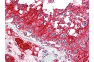 Human Testis (formalin-fixed, paraffin-embedded) stained with ACE2at 2. (ACE2 antibody  (N-Term))