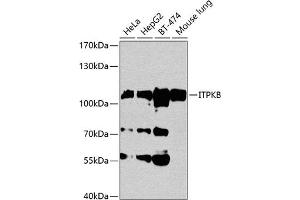Western blot analysis of extracts of various cell lines, using ITPKB antibody (ABIN1680537, ABIN3018302, ABIN3018303 and ABIN6220431) at 1:1000 dilution. (ITPKB antibody  (AA 1-260))
