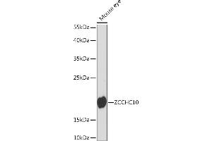 Western blot analysis of extracts of Mouse eye, using ZCCHC10 Rabbit pAb (ABIN7271545) at 1:1000 dilution. (ZCCHC10 antibody  (AA 1-100))