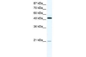 Western Blotting (WB) image for anti-Tumor Necrosis Factor Receptor Superfamily, Member 11b (TNFRSF11B) (N-Term) antibody (ABIN925985)