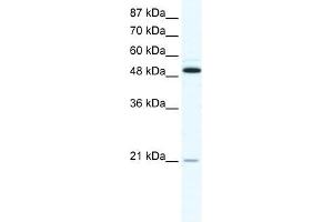 TNFRSF11B antibody (20R-1284) used at 0. (Osteoprotegerin antibody  (N-Term))