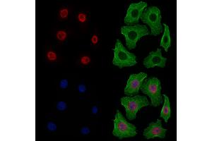 ABIN6256820 and ABIN6277498 staining Hela cells by IF/ICC.