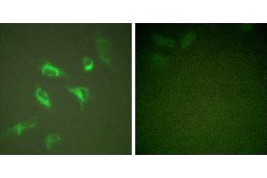 PMA + -Immunofluorescence analysis of HeLa cells, treated with PMA (125ng/ml, 30mins), using 14-3-3 ζ (Ab-58) antibody (#B0001).
