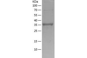 Western Blotting (WB) image for Growth Differentiation Factor 5 (GDF5) (AA 382-501) protein (His-IF2DI Tag) (ABIN7281871) (GDF5 Protein (AA 382-501) (His-IF2DI Tag))