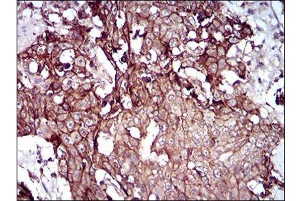 Desmoglein 3 antibody  (AA 55-159)