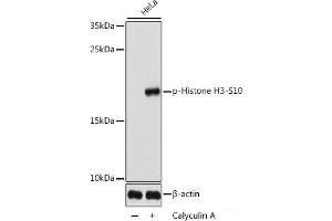 Western blot analysis of extracts of HeLa cells using Phospho-Histone H3(S10) Polyclonal Antibody at dilution of 1:1000. (Histone 3 antibody  (pSer10))