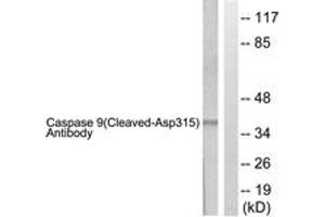 Western blot analysis of extracts from 293 cells, treated with Etoposide 25uM 60', using Caspase 9 (Cleaved-Asp315) Antibody. (Caspase 9 antibody  (Cleaved-Asp315))