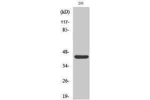 Western Blotting (WB) image for anti-RAD52 Homolog (S. Cerevisiae) (RAD52) (Thr56) antibody (ABIN3177110) (RAD52 antibody  (Thr56))
