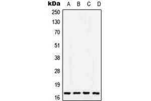 Western blot analysis of COX5A expression in MCF7 (A), SP2/0 (B), PC12 (C), Human liver (D) whole cell lysates. (COX5A antibody  (Center))
