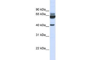 Western Blotting (WB) image for anti-Par-6 Partitioning Defective 6 Homolog beta (PARD6B) antibody (ABIN2458688)