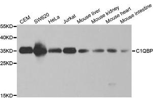 Western blot analysis of extracts of various cell lines, using C1QBP antibody.