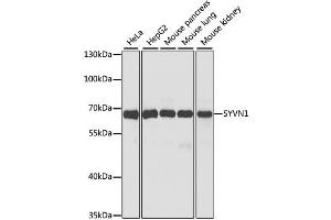Western blot analysis of extracts of various cell lines, using SYVN1 antibody (ABIN1875011) at 1:1000 dilution. (SYVN1 antibody)